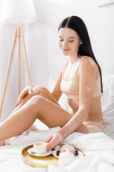 joyful woman with vitiligo taking cup of coffee on tray