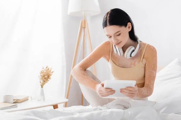 Young Woman Vitiligo Wireless Headphones Holding Digital Tablet Bedroom — Stock Photo, Image