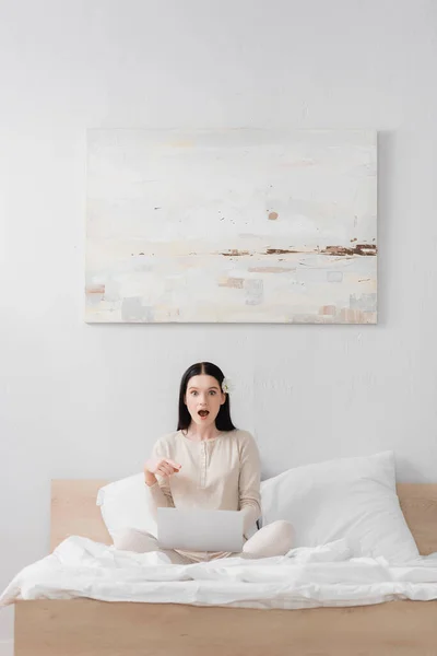 Shocked freelancer with vitiligo pointing with finger at laptop in bedroom — Stock Image Shocked Freelancer Vitiligo Pointing Finger Laptop Bedroom Stock Photo