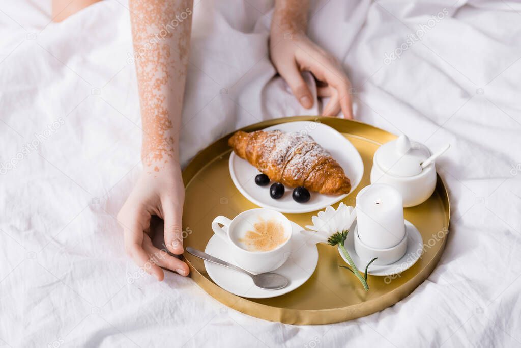 partial view of woman with vitiligo touching tray with breakfast