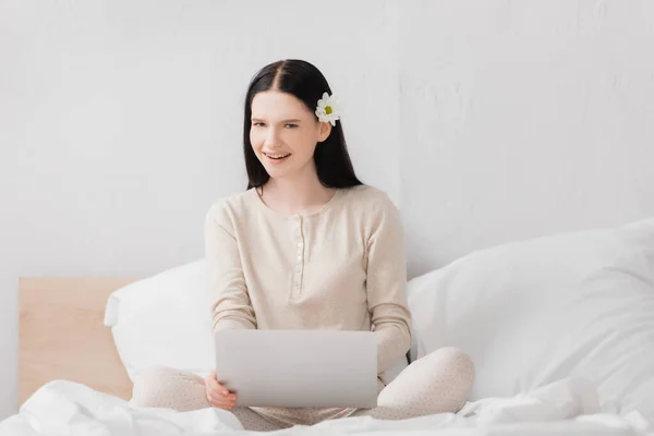 Freelance souriant avec vitiligo et fleur dans les cheveux en utilisant un ordinateur portable dans la chambre — Photo de stock