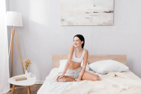 Cheerful woman with vitiligo smiling while sitting on bed near coffee table — Stock Photo