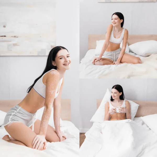 Collage de mujer alegre con vitiligo sonriendo y sosteniendo taza de té en la cama - foto de stock