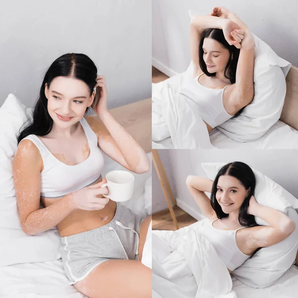 Коллаж счастливой женщины с витилиго улыбаясь и держа чашку чая в постели — стоковое фото