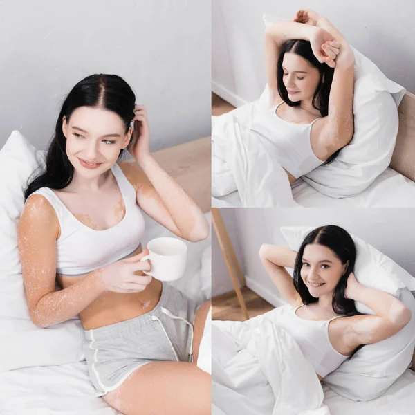 Collage di donna felice con vitiligine sorridente e tenendo in mano una tazza di tè a letto — Foto stock