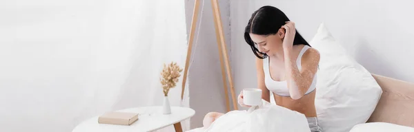 Mujer sonriente con vitiligo sosteniendo taza de café mientras fija el cabello en la cama, pancarta - foto de stock