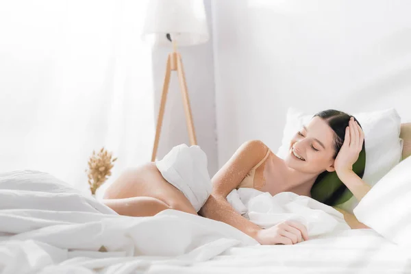 Молода щаслива жінка з вітіліго лежить на ліжку — стокове фото