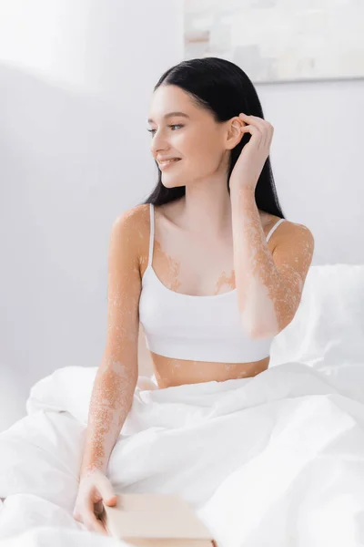 Young happy woman with vitiligo adjusting hair in bedroom — Stock Photo