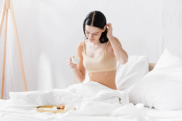 Mujer con vitiligo sosteniendo la taza y fijando el cabello cerca de la bandeja del desayuno - foto de stock