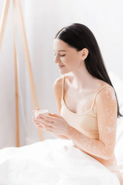 Joven feliz mujer con vitiligo celebración taza de café - foto de stock