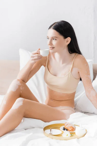 Jeune femme heureuse avec vitiligo tenant tasse près du plateau de petit déjeuner sur le lit — Photo de stock