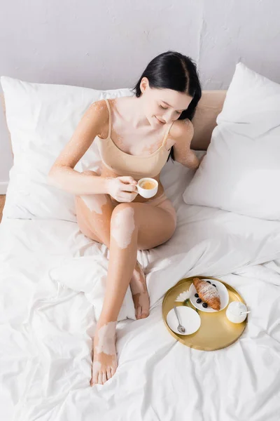 Vista de ángulo alto de la mujer alegre con vitiligo tomando taza de café en bandeja - foto de stock