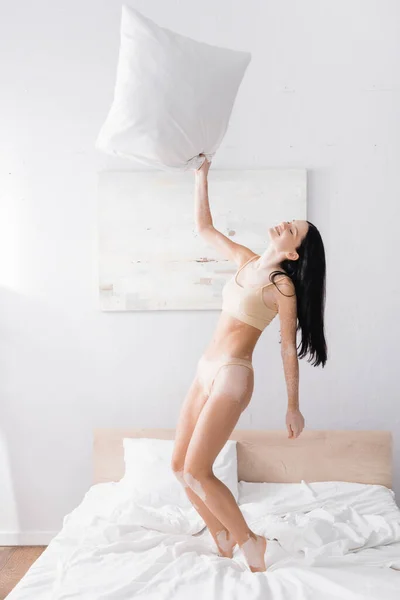 Pleine longueur de femme joyeuse avec vitiligo avoir du plaisir dans la chambre — Photo de stock