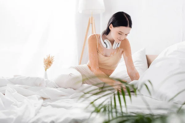 Femme avec vitiligo dans les écouteurs sans fil tenant tablette numérique avec plante au premier plan flou — Photo de stock