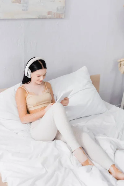 Happy woman with vitiligo in wireless headphones holding digital tablet in bedroom — Stock Photo
