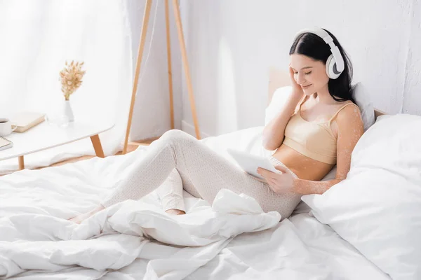 Усміхнена жінка з вітіліго в бездротових навушниках тримає цифровий планшет у спальні — стокове фото