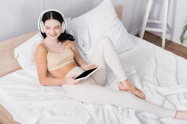 Mujer feliz con vitiligo en auriculares inalámbricos sosteniendo tableta digital con pantalla en blanco en el dormitorio - foto de stock