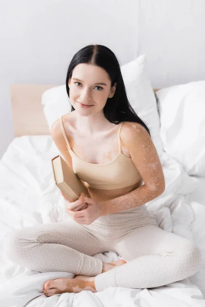 Mulher feliz com vitiligo segurando livro e olhando para a câmera no quarto — Fotografia de Stock