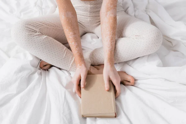 Частичный вид женщины с витилиго проведение книги в спальне — стоковое фото