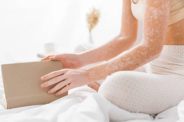 Vista recortada de la mujer con vitiligo libro de celebración en el dormitorio - foto de stock