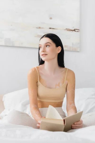 Morena mujer con vitiligo sosteniendo libro y sentado en el dormitorio - foto de stock