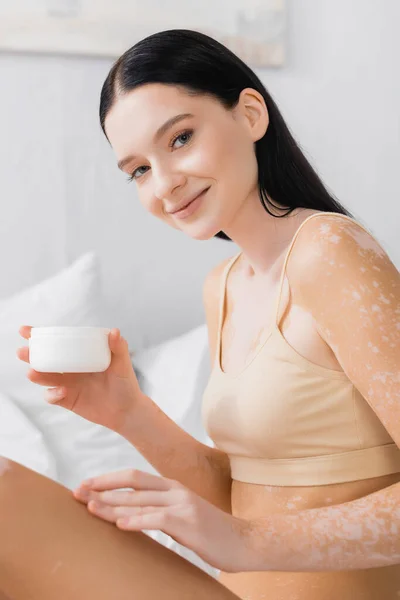 Femme heureuse avec vitiligo assis sur le lit et tenant récipient avec crème cosmétique — Photo de stock