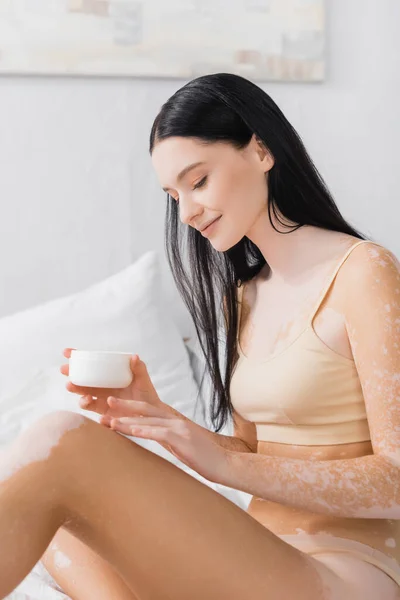 Morena joven con vitiligo sentado en la cama y sosteniendo contenedor con crema cosmética - foto de stock