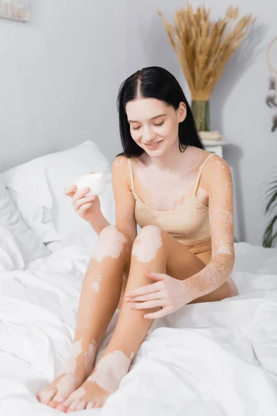 Glückliche junge Frau mit Vitiligo sitzt auf dem Bett und hält Behälter mit kosmetischer Creme — Stockfoto