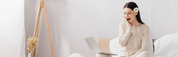 Femme choquée avec vitiligo et fleur dans les cheveux en utilisant un ordinateur portable dans la chambre, bannière — Photo de stock