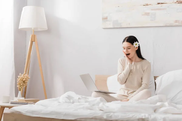 Shocked woman with vitiligo and flower in hair using laptop in bedroom — Stock Photo