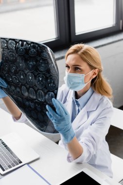 Tıbbi maskeli doktorun ellerinde röntgen ve bulanık arka planda lateks eldivenler.