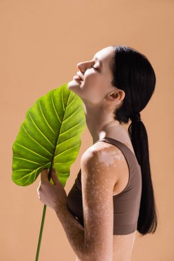 side view of smiling young beautiful woman with vitiligo posing with green leaf isolated on beige clipart