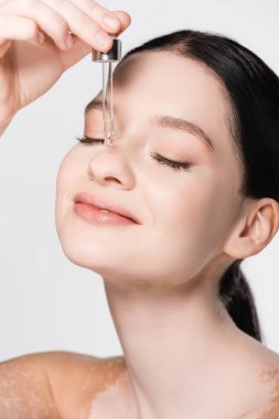 gülümseyen genç ve güzel bir kadın vitiligo ile yüzüne serumu uyguluyor beyaza izole edilmiş halde.