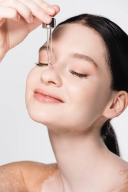 smiling young beautiful woman with vitiligo applying serum on face isolated on white clipart