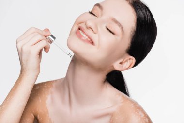 Gülümseyen genç ve güzel bir kadın vitiligo ile serumu beyaza uyguluyor.