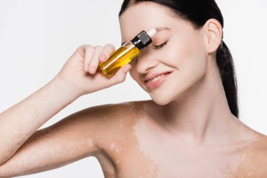 Gülümseyen, vitiligo 'su olan genç, güzel bir kadın.