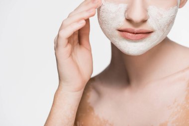 Vitiligo ve kilden maske takmış beyaz tenli kadın görüntüsü