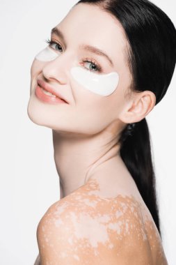 Gülümseyen genç ve güzel bir kadın Vitiligo ve göz bantları beyaz üzerinde izole edilmiş.