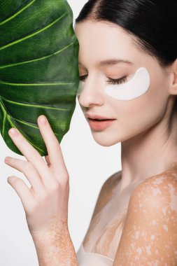 Beyaz yapraklı yeşil yaprağın yanında vitiligo ve göz bantları olan genç ve güzel bir kadın.