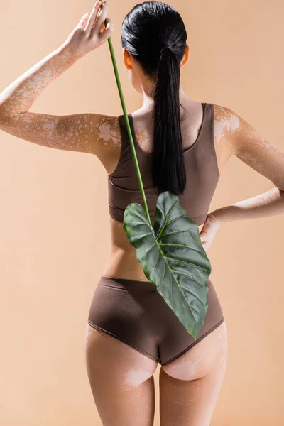 Vista Posterior Joven Hermosa Mujer Con Vitiligo Posando Con Hoja — Foto de Stock