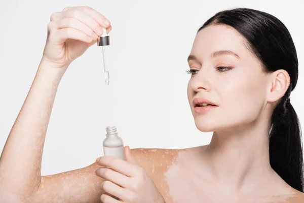 Jovem Bela Mulher Com Vitiligo Segurando Soro Isolado Branco — Fotografia de Stock