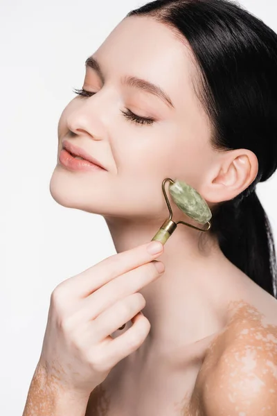 Smiling Young Beautiful Woman Vitiligo Using Jade Roller Face Isolated — Stock Photo, Image