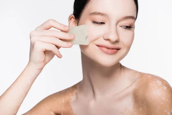 Smiling Young Beautiful Woman Vitiligo Using Gua Sha Isolated White — Stock Photo, Image