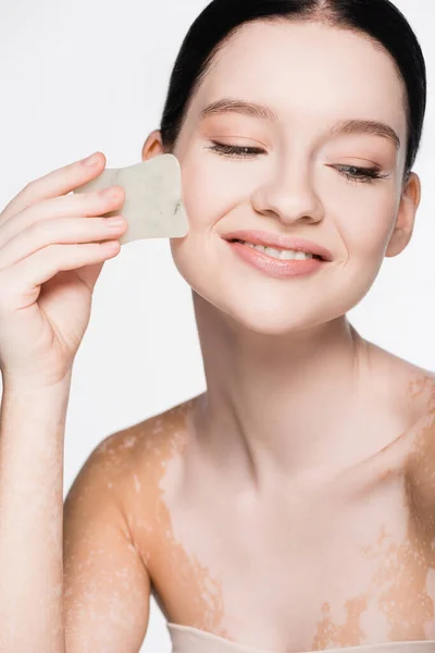 Wanita Cantik Tersenyum Dengan Vitiligo Menggunakan Gua Sha Terisolasi Atas — Stok Foto