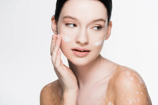 Young Beautiful Woman Vitiligo Facial Cream Cheeks Isolated White — Stock Photo, Image