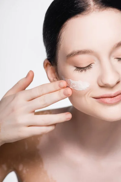 Vista Recortada Joven Hermosa Mujer Con Vitiligo Crema Facial Mejilla — Foto de Stock