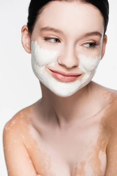 Smiling Young Beautiful Woman Vitiligo Clay Mask Face Isolated White — Stock Photo, Image