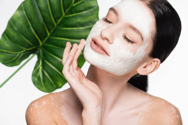 Young Beautiful Woman Vitiligo Clay Mask Face Blurred Leaf Background — Stock Photo, Image