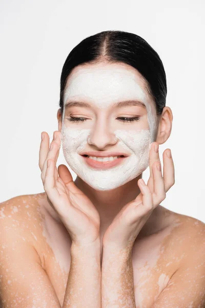 Sonriente Joven Hermosa Mujer Con Vitiligo Máscara Arcilla Cara Aislada —  Fotos de Stock