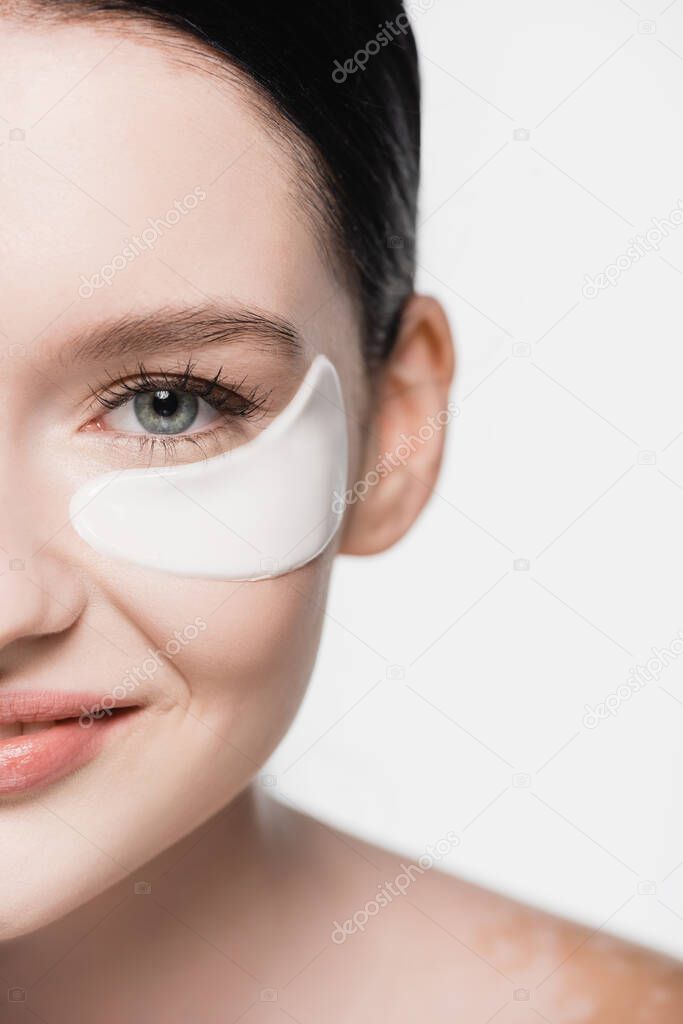 cropped view of smiling young beautiful woman with vitiligo and eye patches on face isolated on white